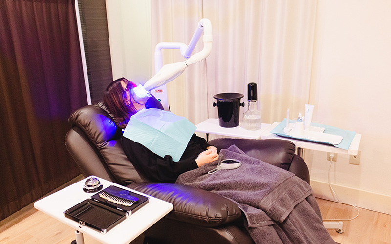 歯のセルフホワイトニング